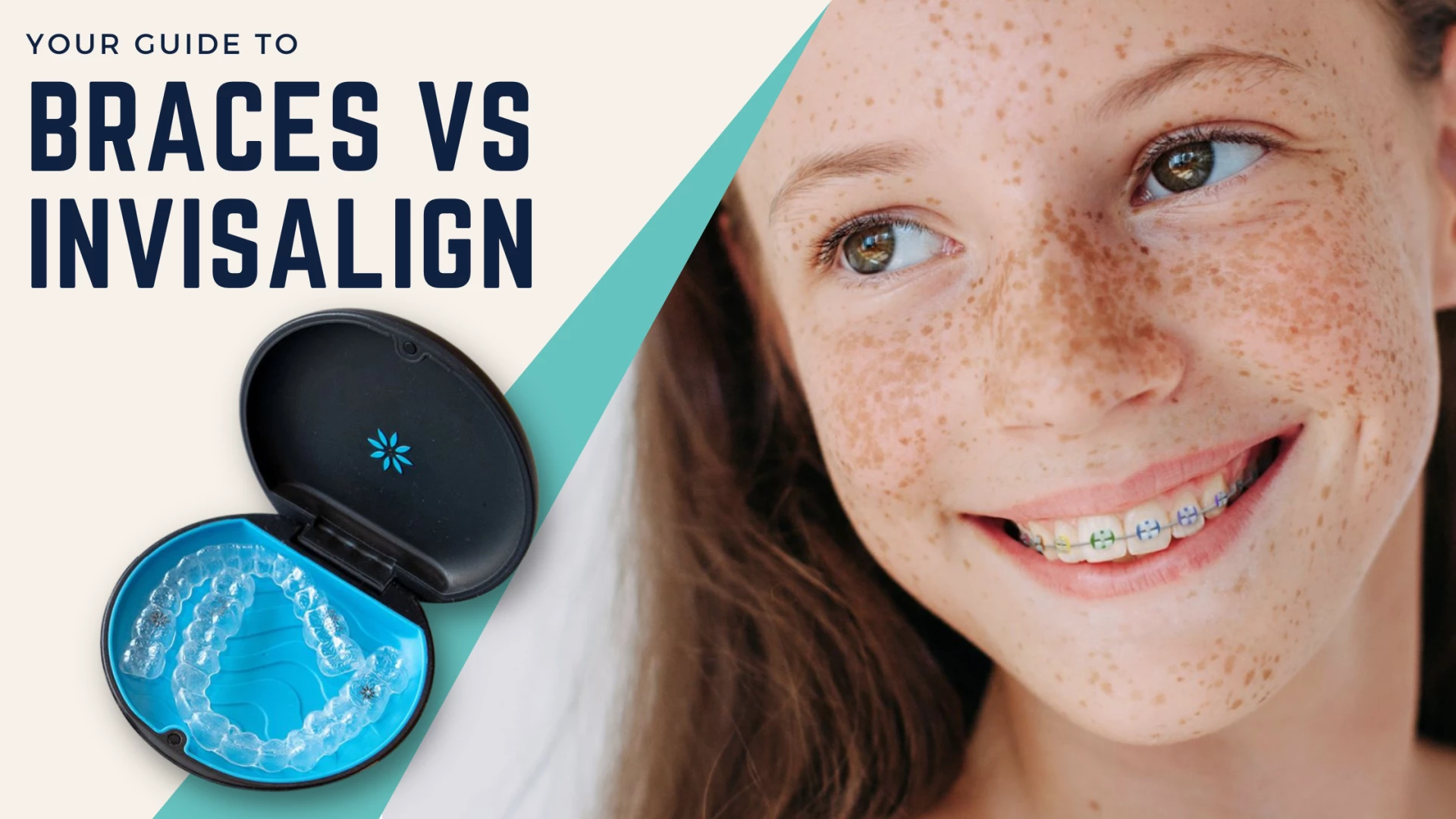 Invisalign Vs. Braces: Cost, Effectiveness, and Appearance